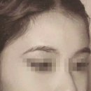 지방간의 진단과 관리 | 부산 풀페이스 얼굴지방이식 상담 투어 후기