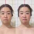구덕로 | 대신동피부관리 비체스킨앤바디랩 안면비대칭 윤곽관리 후기