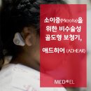 소이애드