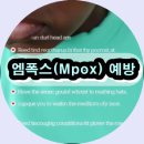 망성금지보건진료소 | 엠폭스(Mpox) 예방수칙 5가지ㅣ 일상에서 꼭 지켜야 할 건강 습관