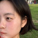 더예쁨의원 | [피부과 후기] 더예쁨의원에 간 얼굴 뒤집어진 예민 아토피 피부사람의 충격 상담 및 각종 크림 리뷰...