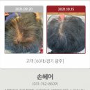 손헤어에 가면 탈모 걱정 끝입니다