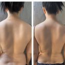 행정서로1길 | 짱언니뷰티살롱 향남본점에서 등관리받고 등라인 확실히 달라진 후기