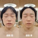 세븐일레븐서구행복점 | 광주 윤곽관리 테라피스파 소베 상무점 윤곽관리 추천 후기!