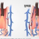#간경변증(간경화)관리 후기