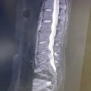 닥터베이직랩 | 수술 후, 회사 복귀 후 1주일 | 루나랩 전동책상 내돈내산 사용후기 | 사이즈오브 의자 프로 버전 구입...