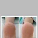 레푸스죽전새터점