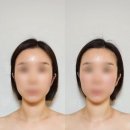 (주)제이메디케어 | [사당동/남성역] '전스에스테틱' 에서 V7파워윤곽 파워트리 관리받은 후기