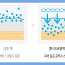 플로르성형외과 이미지