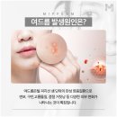미소지움피부과의원 이미지