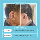 345 | 대전 대덕구 보청기,고XX고객님 인피니오 스피어 90 구매후기(50대,男)