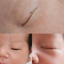 글로리병원 | 눈물샘 막힘으로 고생하던 아꿍이 &lt;창원글로리안과&gt; 방문하고 광명찾다🤩🤩 - &lt;창원글로리안과&gt; 후기