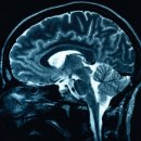 당신의 `뇌`가 손상됐다는 증거 (후유증이 무섭다..) 이미지