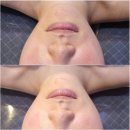 <대구>대구피부관리 신부관리 김현정에스테틱 솔직후기
