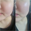띵쏘 피부공학 속건조앰플 보습세럼