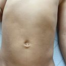 유일 효 태권도 | 아이아토피 완치로 가는중!! 관리 및 생활루틴