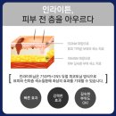 몽고반점 이미지