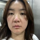 아비쥬의원부평 이미지