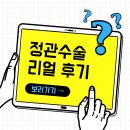 정관수술 후기(리얼 100%)