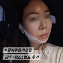 광주 피부탄력 레이저 네오스컬프 팔자주름리프팅 후기
