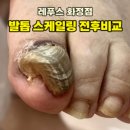 레푸스 화정점 이미지