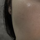 넥스유지 | 채정안 PICK 아로셀 마스크 멜라 TXA 트라넥스로 초간단 기미관리