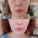 브로우N브로우