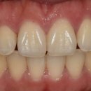 미라클치과기공소 이미지