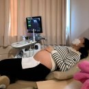 분당-94 | 분당제일여성병원 제왕절개 출산후기 (1인실 나형, 일일조리원, 주치의 변지혜 과장님)