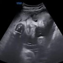 서초대로34가길 33 (1) | 임신 일기 🤰🏻 | 31주~34주 :: 인구보건복지협회(가족보건의원) 백일해 주사 접종, 빨래공장, 출산휴가 시작