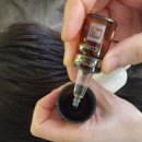 모코드두피탈모센터 이미지