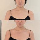 캐롤뷰티 | 신논현윤곽관리 신부관리 캐롤뷰티 수기 비대칭 관리 후기