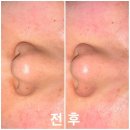 경주피부관리 NMN,MTS케어 피어나스킨엔바디 다녀오고 추천하는 이유