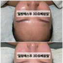 힐링에스투