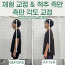 혜민 PC | [구월동PT] 학생PT 거북목·라운드 숄더 교정 Before &amp; After