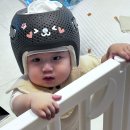 이노야드 두상교정센터 석촌호수 | 아기 두상교정 헬멧 이노야드 내돈내산 솔직후기! 사두 단두 교정 효과, 부작용, 비용 까지 총정리