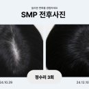 걸&보이헤어라인