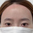 남산4길 | 대구헤어라인왁싱 '이룸뷰티'에서 헤어라인왁싱 받고 온 솔직한 후기 남산역왁싱 잘하는 곳