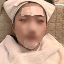 데자뷰메디스킨 대구점에서 아쿠아필링 받고 온 후기