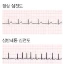 세동 이미지