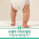 신생아 기저귀 발진! 어떻게 예방할까? 이미지