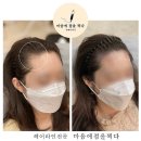 마음에점을찍다두피SMP 이미지