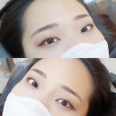 미소핀