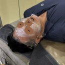 한피부과의원 | 강남역 피부과 리디아여성의원 | 사마귀• 점 빼기 한달 이상 경과 솔직 후기