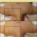 전주 혁신도시 등관리 잘하는 곳 사라의시간피부&amp;바디 연구소