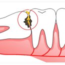 닥터굿플란트치과의원 이미지