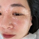 [진주에스테틱] 채지움뷰티의 차별화된 닥터필 솔직후기