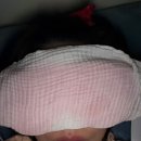 대자연약국 | [쌍수일기_3화]수술3-6일차(실밥제거)멍,붓기와의 전쟁/비절개눈매교정+매몰법+윗트임후기