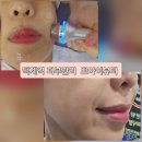 뽀아이뷰티 | 덕계역 피부관리 뽀아이뷰티 물방울초음파 솔직한 후기
