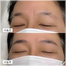 신도림남자눈썹문신, 만족후기 '리메이드 서울본점'